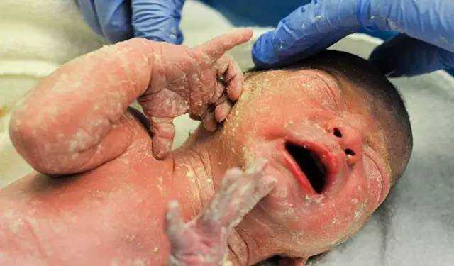 重庆代检机构：月经量少代孕二胎怎么办